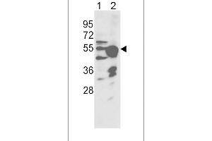 Western blot analysis of CYP2R1 Antibody (Center) (ABIN392380 and ABIN2842012) in NCI- cell line(lane 1) and mouse liver tissue(lane 2) lysates (35 μg/lane). (CYP2R1 Antikörper  (AA 152-180))