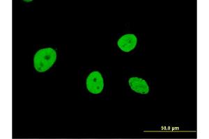 Immunofluorescence of monoclonal antibody to NOL4 on HeLa cell. (NOL4 Antikörper  (AA 425-524))