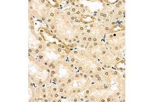 Immunohistochemistry of paraffin embedded rat kidney using HES3 (ABIN7074159) at dilution of 1:1000 (400x lens)