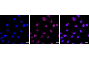 Immunocytochemical staining of Hela cells with PSIP1 antibody (ABIN7799746), 1:1,000). (Rekombinanter PSIP1 Antikörper)