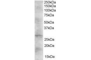 Western Blotting (WB) image for Dickkopf 2 Homolog (DKK2) peptide (ABIN368774) (Dickkopf 2 Homolog (DKK2) Peptid)