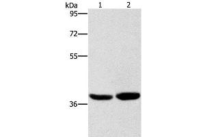 Western Blot analysis of Human fetal brain tissue and 231 cell using CAB39L Polyclonal Antibody at dilution of 1:400 (CAB39L Antikörper)
