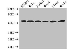 Western Blot Positive WB detected in: HEK293 whole cell lysate, Hela whole cell lysate, Jurkat whole cell lysate, Mouse heart tissue, Mouse liver tissue, Mouse brain tissue All lanes: ARIH2 antibody at 3 μg/mL Secondary Goat polyclonal to rabbit IgG at 1/50000 dilution Predicted band size: 58 kDa Observed band size: 58 kDa (ARIH2 Antikörper  (AA 43-360))