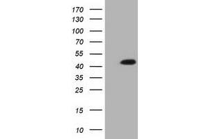 Western Blotting (WB) image for anti-Isovaleryl-CoA Dehydrogenase (IVD) antibody (ABIN1498919) (IVD Antikörper)