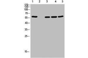 Western Blot analysis of 1,mouse-lung 2,mouse-spleen 3,mouse-kidney 4,mouse-heart 5,293 cells using primary antibody diluted at 1:500(4 °C overnight). (AVPR2 Antikörper  (AA 1-50))