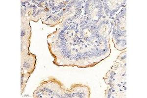 Immunohistochemistry of paraffin embedded mouse duodenum using ADCY4 (ABIN7072959) at dilution of 1: 700 (400x lens)