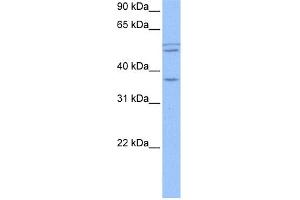 WB Suggested Anti-CCDC78 Antibody Titration: 0. (CCDC78 Antikörper  (Middle Region))