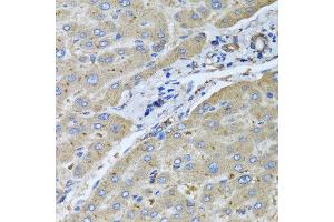 Immunohistochemistry of paraffin-embedded human liver injury using UGT2B10 antibody at dilution of 1:100 (x40 lens). (UGT2B10 Antikörper)