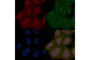 USP21 Mouse Monoclonal Antibody staining Hela cells by IF/ICC. (USP21 Antikörper)
