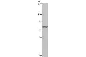 Gel: 6 % SDS-PAGE, Lysate: 40 μg, Lane: Hela cells, Primary antibody: ABIN7130441(NOC2L Antibody) at dilution 1/200, Secondary antibody: Goat anti rabbit IgG at 1/8000 dilution, Exposure time: 5 seconds (NOC2L Antikörper)