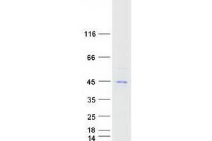 Validation with Western Blot