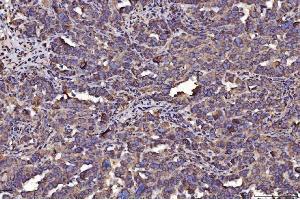 IHC analysis of PDIA6 using anti-PDIA6 antibody (ABIN7600554). (PDIA6 Antikörper  (AA 20-440))