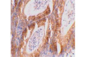Immunohistochemical staining of mouse testis tissue using BCL2L14 polyclonal antibody  at 2 ug/mL . (BCL2L14 Antikörper  (C-Term))