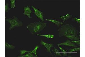 Immunofluorescence of monoclonal antibody to TXK on HeLa cell. (TXK Antikörper  (AA 131-230))