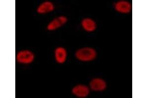 ABIN6275693 staining Hela by IF/ICC. (ZNF592 Antikörper  (Internal Region))