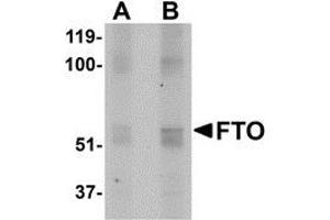 Western blot analysis of FTO in human uterus tissue lysate with AP30350PU-N FTO antibody at (A) 1 and (B) 2 μg/ml. (FTO Antikörper  (N-Term))