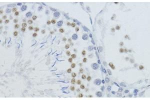 Immunohistochemistry (Paraffin-embedded Sections) (IHC (p)) image for anti-Histone H4 (meLys20) antibody (ABIN7260398)