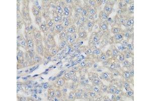 Immunohistochemistry of paraffin-embedded Rat liver using METTL7A Polyclonal Antibody at dilution of 1:200 (40x lens). (METTL7A Antikörper)