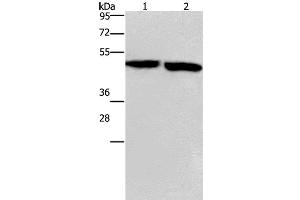 Western Blot analysis of Mouse stomach and brain tissue using CLUAP1 Polyclonal Antibody at dilution of 1:500 (CLUAP1 Antikörper)