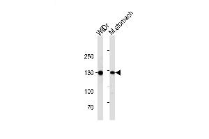Lane 1: WiDr, Lane 2: mouse stomach lysate at 20 µg per lane, probed with bsm-51214M CDH1 (813CT11. (E-cadherin Antikörper)