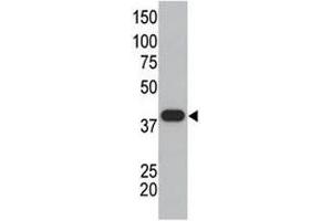 SUMO polyclonal antibody used in western blot to detect GST-SUMO1 fusion protein. (SUMO1 Antikörper  (AA 55-86))