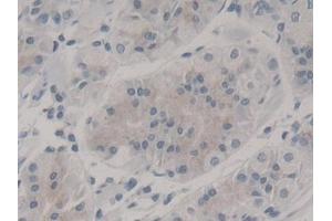 DAB staining on IHC-P; Samples: Human Stomach Tissue (Nestin Antikörper  (AA 178-399))