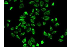 Immunofluorescence analysis of A-549 cells using HSD3B2 antibody (ABIN6131145, ABIN6142018, ABIN6142019 and ABIN6218943). (HSD3B2 Antikörper  (AA 1-287))