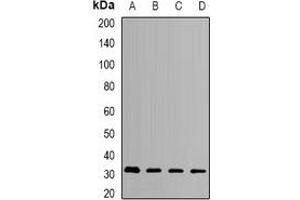 Western blot analysis of HMGCL expression in SKOV3 (A), MCF7 (B), mouse liver (C), mouse kidney (D) whole cell lysates. (HMGCL Antikörper)