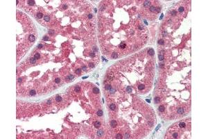 IDH1 antibody was used for immunohistochemistry at a concentration of 4-8 ug/ml. (IDH1 Antikörper)