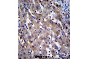 RPGR Antibody (C-term) immunohistochemistry analysis in formalin fixed and paraffin embedded human liver tissue followed by peroxidase conjugation of the secondary antibody and DAB staining. (RPGR Antikörper  (C-Term))