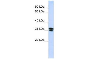 RNF182 antibody used at 1 ug/ml to detect target protein. (RNF182 Antikörper  (N-Term))