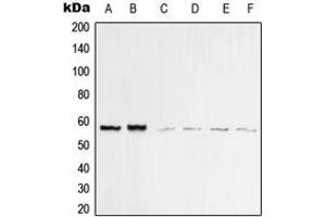 Western blot analysis of Vimentin expression in MCF7 (A), MDAMB435 (B), KNRK (C), HeLa (D), Raw264. (Vimentin Antikörper  (C-Term))