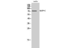 Western Blotting (WB) image for anti-Solute Carrier Organic Anion Transporter Family, Member 1B1 (SLCO1B1) (Internal Region) antibody (ABIN3185986) (SLCO1B1 Antikörper  (Internal Region))