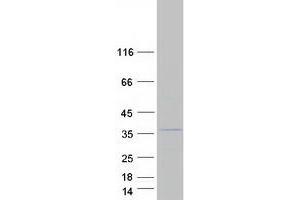 Western Blotting (WB) image for F-Box Protein 6 (FBXO6) protein (Myc-DYKDDDDK Tag) (ABIN2720968)