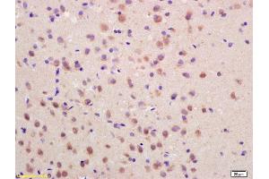 Formalin-fixed and paraffin embedded rat brain labeled with Rabbit Anti SOCS3 Polyclonal Antibody, Unconjugated (ABIN670416) at 1:200 followed by conjugation to the secondary antibody and DAB staining (SOCS3 Antikörper  (AA 155-225))