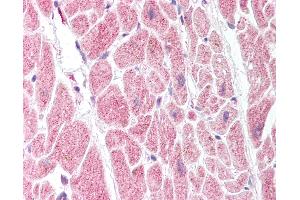 Anti-PTGIS antibody IHC of human heart. (PTGIS Antikörper  (AA 475-490))