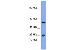 WB Suggested Anti-MB Antibody Titration:  0. (MB Antikörper  (N-Term))