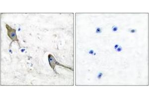 Immunohistochemistry analysis of paraffin-embedded human brain tissue, using PYK2 (Ab-881) Antibody. (PTK2B Antikörper  (AA 847-896))