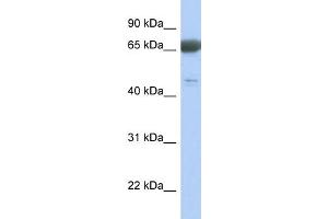 WB Suggested Anti-PNMA3 Antibody Titration: 0. (PNMA3 Antikörper  (Middle Region))