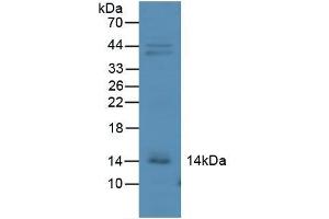 Detection of IP10 in Mouse Kidney Tissue using Polyclonal Antibody to Interferon Gamma Induced Protein 10 kDa (IP10) (CXCL10 Antikörper  (AA 22-98))