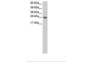 Image no. 1 for anti-Transcription Elongation Factor A2 (TCEA2) (AA 45-94) antibody (ABIN202191) (TCEA2 Antikörper  (AA 45-94))