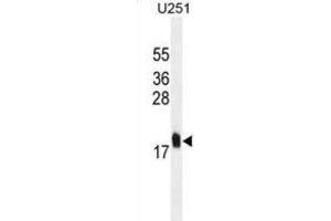 Western Blotting (WB) image for anti-Multiple Coagulation Factor Deficiency 2 (MCFD2) antibody (ABIN2995326) (MCFD2 Antikörper)