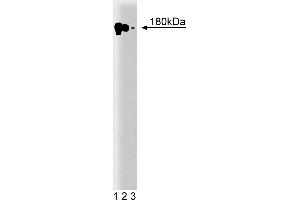 Western Blotting (WB) image for anti-Epidermal Growth Factor Receptor (EGFR) (AA 1020-1046) antibody (ABIN967697) (EGFR Antikörper  (AA 1020-1046))