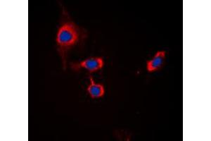 Immunofluorescent analysis of GABRB1 (pS434) staining in MCF7 cells. (GABRB1 Antikörper  (C-Term, pSer434))