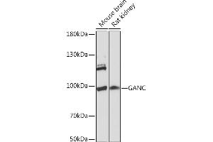 Western blot analysis of extracts of various cell lines, using GANC Rabbit pAb (ABIN7267406) at 1:1000 dilution. (GANC Antikörper  (AA 100-200))