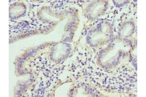 Immunohistochemistry of paraffin-embedded human duodenal tissue using ABIN7167845 at dilution of 1:100 (RBP2 Antikörper  (AA 1-134))