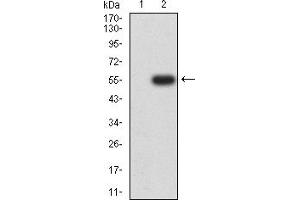 Western Blotting (WB) image for anti-Cholinergic Receptor, Nicotinic, alpha 6 (CHRNA6) (AA 26-239) antibody (ABIN5611358)