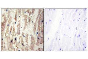 Immunohistochemistry (IHC) image for anti-Laminin, alpha 4 (LAMa4) (Internal Region) antibody (ABIN1850448) (LAMa4 Antikörper  (Internal Region))