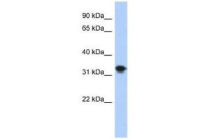 CENPP antibody used at 1 ug/ml to detect target protein. (CENPP Antikörper  (N-Term))