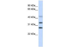 WB Suggested Anti-CENPH Antibody Titration: 0. (CENPH Antikörper  (Middle Region))